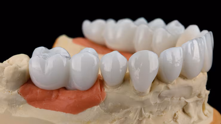 Zirconia / Porcelain Crowns